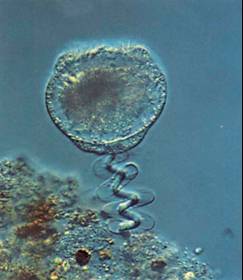 vorticella contraction.jpg